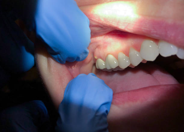 Best Weekend Emergency Dentist in Key Vista, FL